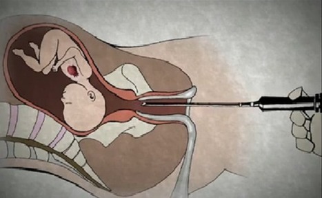New Late-Term Abortion Clinics Will Shoot Babies Through the Heart With Poison to Kill Them | Industry 411 - Waste Management | Scoop.it