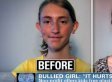 Charity Pays For Teen's Plastic Surgery To Fight Bullying | Cyberbullying, it's not a game! It's your Life!!! | Scoop.it