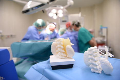 Surgeons Use 3D Printing to Remove Previously Inoperable Tumour From Child | 21st Century Innovative Technologies and Developments as also discoveries, curiosity ( insolite)... | Scoop.it