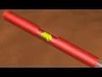 Drug Eluting Stent | Interventional Cardiology | Scoop.it