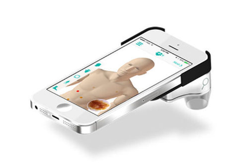 MoleScope : Un microscope connect&eacute; qui inspecte les grains de beaut&eacute; | e-Sant&eacute;, Objets Connect&eacute;, Senior 3.0, Silver Economie, D&eacute;pendance N.0! | Scoop.it