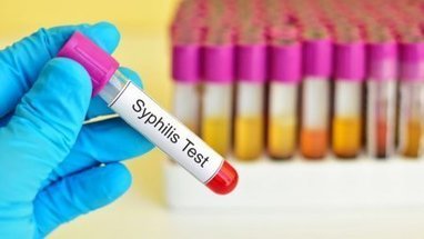 La progression de la syphilis se poursuit en France | sida | Scoop.it