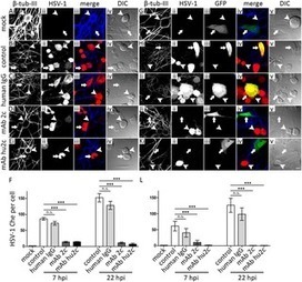 Prevention of Herpes Simplex Virus Induced Stromal Keratitis by a Glycoprotein B-Specific Monoclonal Antibody | Immunology and Biotherapies | Scoop.it