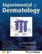 The single-chain anti-TNF-α antibody DLX105 induces clinical and biomarker responses upon local administration in patients with chronic plaque-type psoriasis | Immunology and Biotherapies | Scoop.it