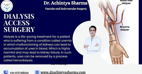 “A Comprehensive Plan by a Varicose Vein Specialist for Guiding You through Treatment of Varicose Veins.” | Dr. Achintya Sharma - Vascular and Endovascular Surgeon | Scoop.it
