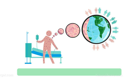 The same media liars who ran total fearmonger stories over the MEASLES nonsense are now claiming the coronavirus pandemic is nothing, and that WE are fearmongers – | Hésitations Vaccinales: Observatoire HESIVAXs | Scoop.it