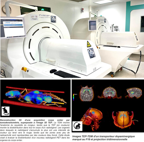 FOCUS PLATEFORME : MIRCEN : de nouvelles cam&eacute;ras TEP-TDM pour l&rsquo;&eacute;tude des maladies neurod&eacute;g&eacute;n&eacute;ratives | Life Sciences Universit&eacute; Paris-Saclay | Scoop.it