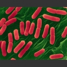 La &laquo; maladie du hamburger &raquo; bient&ocirc;t &eacute;radiqu&eacute;e ? | Microbiologie | Scoop.it