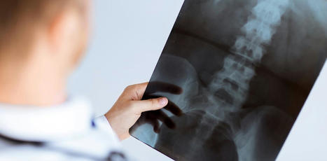 Que montre vraiment l’imagerie médicale en cas de mal de dos ? | Rheumatology-Rhumatologie | Scoop.it