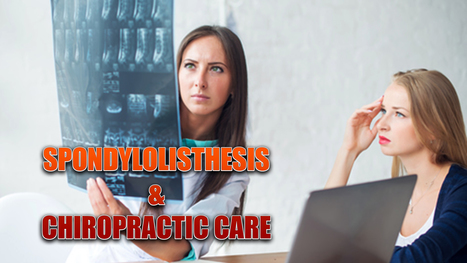 Spondylolisthesis And Chiropractic Care | Dr. Alex Jimenez D.C. | Spine Health & Spinal Hygiene | Scoop.it