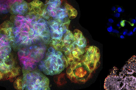 Me and my organoid: a step closer to tailored therapy | Amazing Science | Scoop.it