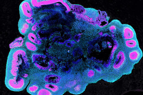 How humans develop larger brains than other apes | Amazing Science | Scoop.it