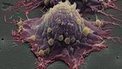 Thriving cancer's 'chaos' explained | Complex Insight  - Understanding our world | Scoop.it