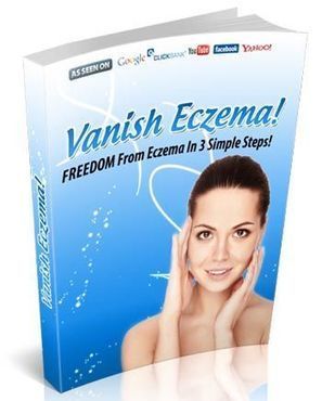 Vanish Eczema Guide PDF Download by Lee Gardner | Ebooks & Books (PDF Free Download) | Scoop.it