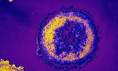 US doctors cure child born with HIV | 21st Century Innovative Technologies and Developments as also discoveries, curiosity ( insolite)... | Scoop.it