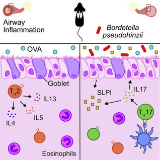 Airway Microbiota-Host Interactions Regulate Secretory Leukocyte Protease Inhibitor Levels and Influence Allergic Airway Inflammation | Allergy (and clinical immunology) | Scoop.it