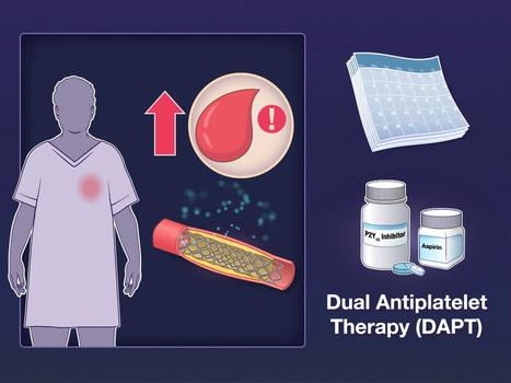 Early aspirin withdrawal versus dual antiplatel...