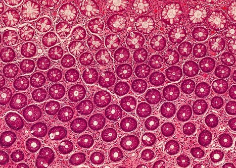 New microscope that fits in a needle and is capable of super-high resolution microscopy through an ultra-thin fiber | Amazing Science | Scoop.it