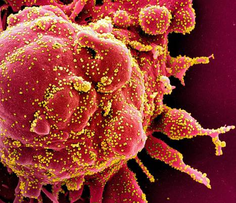 SARS-CoV-2 Close-Up  | dis.infected | Scoop.it