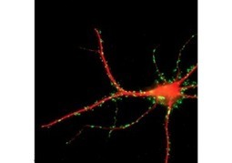Alzheimer : le rôle de la maladie vasculaire se confirme - Neuromedia | Alzheimer, maladies neuro-dégénératives et gérontologie générale | Scoop.it