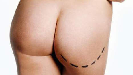 Trop de gras dans les fesses? Congelez-le pour plus tard | Mais n'importe quoi ! | Scoop.it