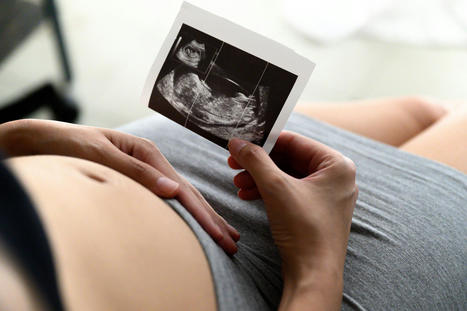 Antiépileptiques pendant la grossesse: les risques pour le fœtus mieux identifiés | Bioéthique & Procréation | Scoop.it
