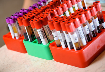 La recrudescence des infections sexuellement transmissibles inquiète les spécialistes | sida | Scoop.it