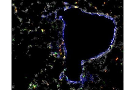 Immunologists identify T cell homing beacons for lungs | Mucosal Immunity | Scoop.it