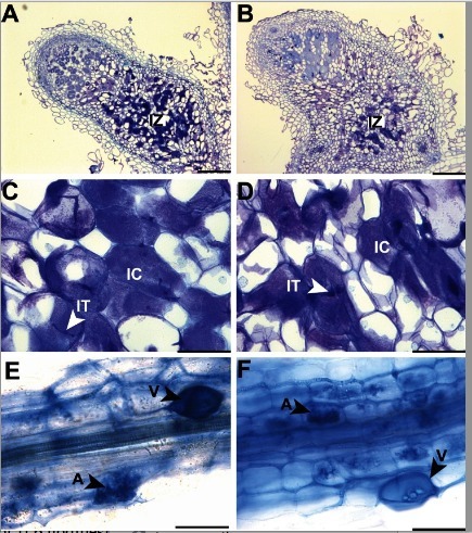 Independent Acquisition of  Nitrogen-Fixing Symbiosis in Fabids Recruited the Same Genetic Pathway for Nodule Organogenesis | Plant-Microbe Symbiosis | Scoop.it