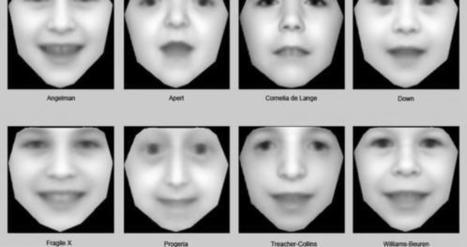 l'Atelier : "La reconnaissance faciale pour mieux déceler les maladies génétiques | Ce monde à inventer ! | Scoop.it