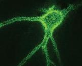 The Brain Set Free - Science News | NeuroPsicoEducación al Día | Scoop.it