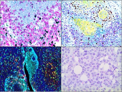 FOCUS PLATEFORME : L’immunohistochimie nouvelle génération, une nouvelle frontière grâce à un nouvel équipement ! | Life Sciences Université Paris-Saclay | Scoop.it