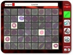 Researchers create an online game to diagnose malaria | GAMIFICATION & SERIOUS GAMES IN HEALTH by PHARMAGEEK | Scoop.it