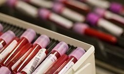 Blood test to detect Parkinson's Disease could Lead to earlier Treatment | Future  Technology | Scoop.it