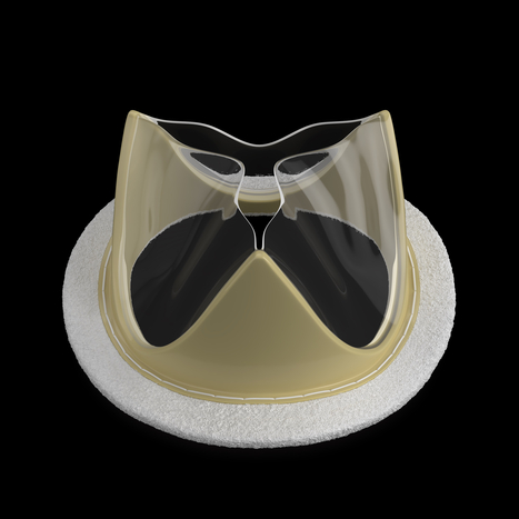 Foldax Secures Approval for TRIA Mitral Heart Valve in India | Transcatheter Treatment of Mitral Regurgitation | Scoop.it