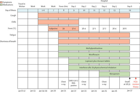 Pathological findings of COVID-19 associated with acute respiratory distress syndrome | Wuhan, Hubei | Scoop.it