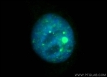 GEN | Magazine Articles: 10 Tips for Selecting The Right Antibody | Immunology Diagnosis | Scoop.it