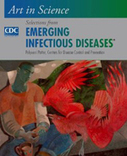 Post-Ebola Syndrome, Sierra Leone | Virology News | Scoop.it