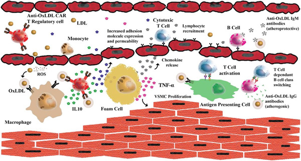 OxLDL-Targeted Chimeric Antigen Receptor T Regulatory Cells Reduce Atherosclerotic Plaque Development | Interventional Cardiology | Scoop.it