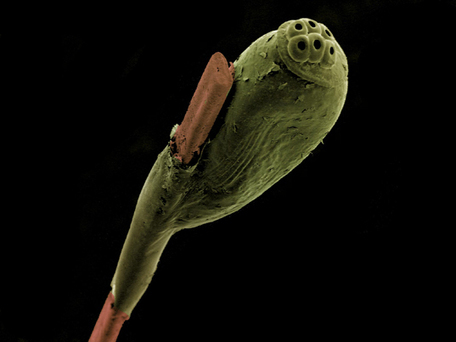 Wellcome Image Awards 2014 : Les plus belles images de science | Variétés entomologiques | Scoop.it