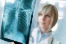 Comment l'IA de GE Healthcare améliore la gestion des flux de patients à l'hôpital | La sélection d'ADI | Scoop.it