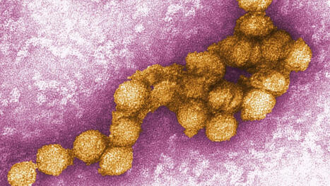 Gesundheit: West-Nil-Virus: Zahl der F&auml;lle in Griechenland steigt stark | Virology News | Scoop.it