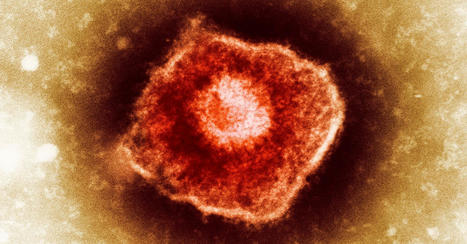 Diseases Didn’t Just Shape History, They Control the Future | dis.infected | Scoop.it