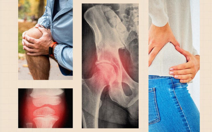 The side effects of hip and knee replacements to know about before surgery | The Health Report | Scoop.it