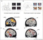 STUDY: Current Opinion in Neurobiology - Empathy circuits | Empathy Movement Magazine | Scoop.it