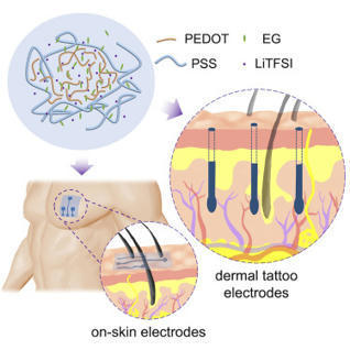 Ultraflexible tattoo electrodes for epidermal and in vivo electrophysiological recording | In-Vitro Diagnostic | Scoop.it