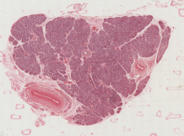 Research news - Pancreatic image bank expected to help advance diabetes research worldwide - University of Exeter | AUTOIMMUNITY | Scoop.it