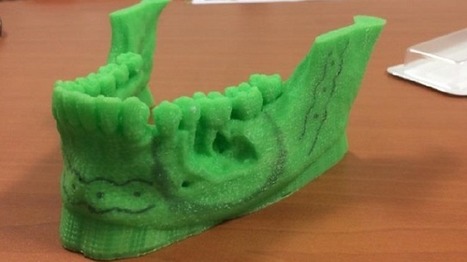 Des chirurgiens toulousains utilisent la 3D pour reconstituer la mâchoire d'une patiente - France 3 Midi-Pyrénées | Revue de presse | Scoop.it