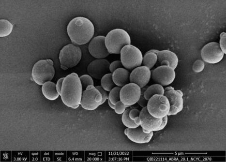 Biologie moléculaire : une levure résistante révélée par la méthode Lamp | Agroalimentaire | Scoop.it