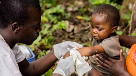 Variole du singe: des journalistes africains condamnent l'utilisation de personnes noires pour illustrer les articles sur la maladie | DocPresseESJ | Scoop.it